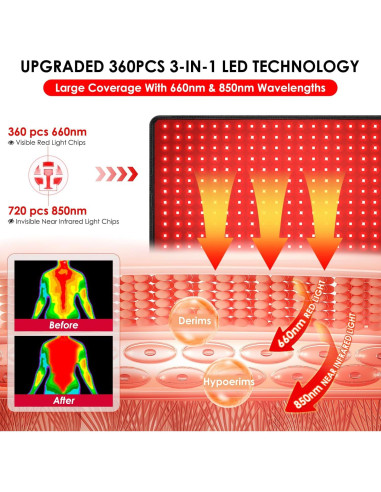 Cinturón de Terapia de Luz Roja 80 x 30 cm Myipyi