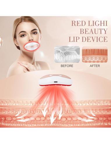 Dispositivo Aumento de Labios Ikedon Luz Roja 2 en 1