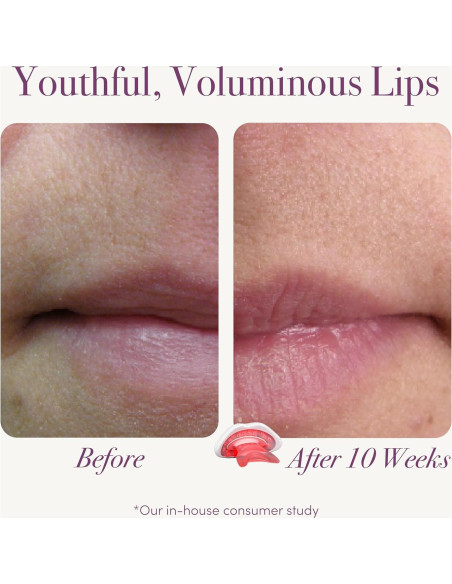 Dispositivo de Terapia de Luz Roja reVive Lux para Labios