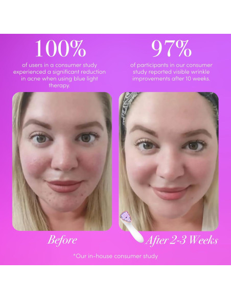 reVive Terapia de Luz Lux Clínica Antienvejecimiento y Acné reVive Terapia de Luz Lux Clínica Antienvejecimiento y Acné