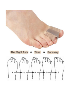 Separadores de Dedos para Juanetes Golbylicc 2PC Gel 2