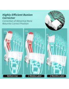 Corrector de Juanetes Ortopédico Kutain Ajustable Blanco 2