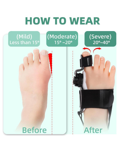 Corrector de Juanetes Ajustable FMGJKQL para Hombres y Mujeres