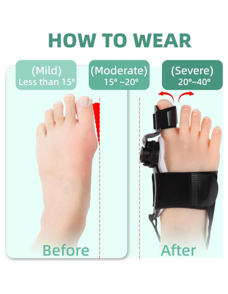 Corrector de Juanetes Ajustable FMGJKQL para Hombres y Mujeres