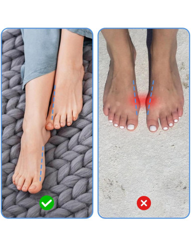 Corrector de Juanetes PEOVLVN 2 Pcs Dedo Grande Alivio