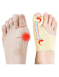 Corrector de Juanetes Qxotvzy Beige para Alivio del Dolor