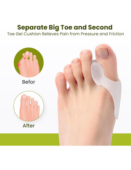 Protector de Almohadilla para Juanetes Bukihome - 8 Piezas Gel