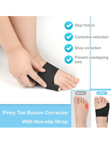 Corrector de Bunionete DYKOOK XL Negro con Almohadillas de Gel