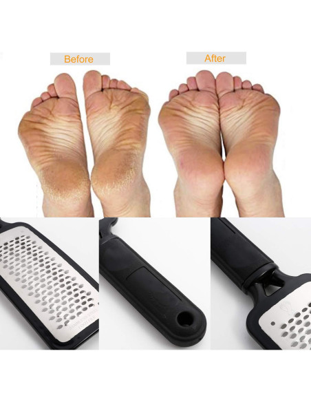 Kit de Pedicura Aimiduo - Removedor de Callos y Lima Inoxidable