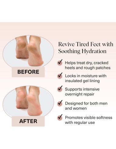 Calcetines Hidratantes Kitsch para Talones Agrietados - 1 Par