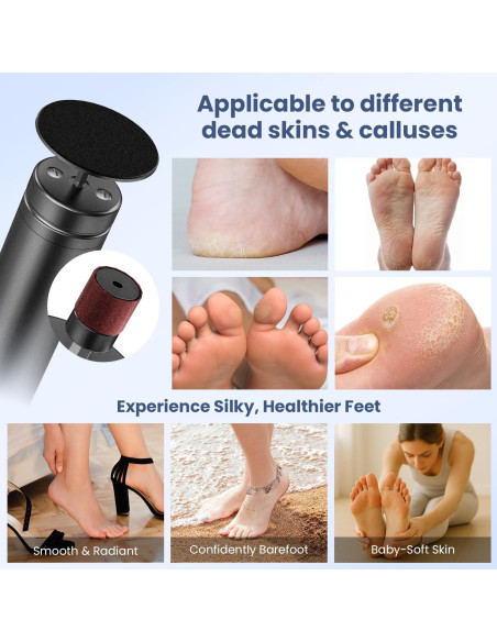 Removedor de Callos Eléctrico Tohecu M10 con 60 Discos Lija