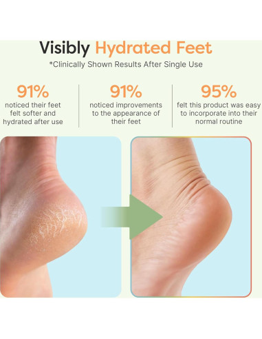 Calcetines Hidratantes ZenToes para Talones Agrietados - Regular