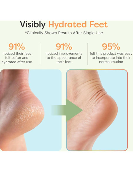 Calcetines Hidratantes ZenToes para Talones Agrietados - Regular