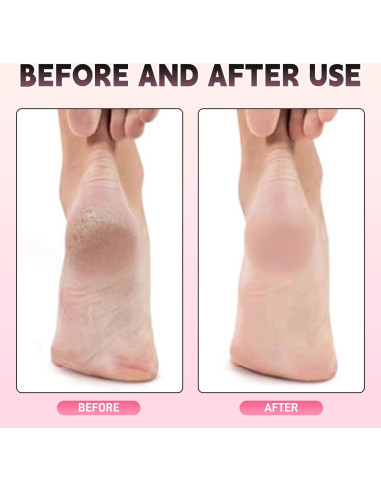 Lima Eléctrica para Pies AJPQCE con 60 Discos y 5 Brocas Rosa