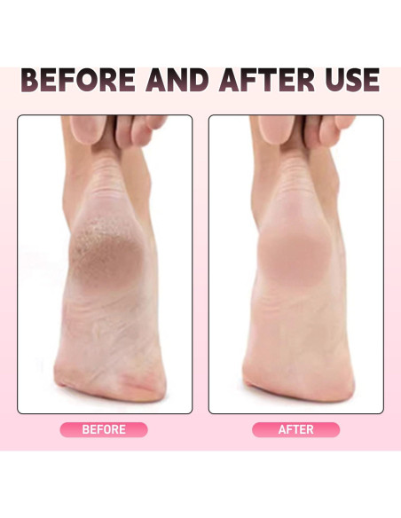 Lima Eléctrica para Pies AJPQCE con 60 Discos y 5 Brocas Rosa