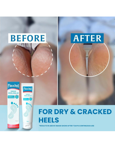 Flexitol Balsamo para Talones 113.4 g - Crema Hidratante y Exfoliante