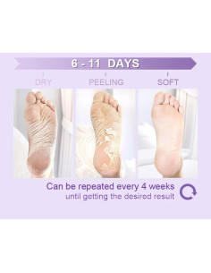 Mascarilla Exfoliante para Pies Maraly - 2 Pares Lavanda 2