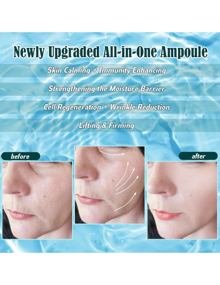 Ampolla Hidro ZEVOFIUR - Suero Facial Hidratante 5 Unidades