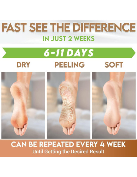 Máscaras Exfoliantes para Pies Karma Organic - Hidratación y Reparación