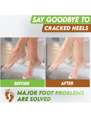 Máscaras Exfoliantes para Pies Karma Organic - Hidratación y Reparación