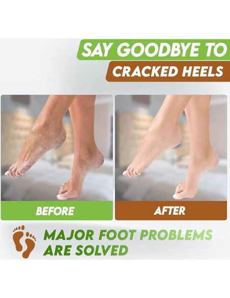 Máscaras Exfoliantes para Pies Karma Organic - Hidratación y Reparación