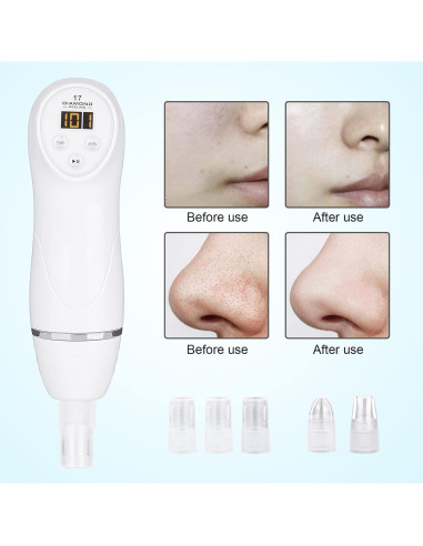 Máquina de Microdermoabrasión Diamante AIMENGXI USB 8 Probetas