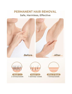 Depiladora Láser IPL LYSMOSKI para Uso Facial y Corporal 2