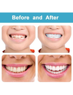 Cubierta de Dientes Falsos AIMUR Superior e Inferior 9x9cm 2