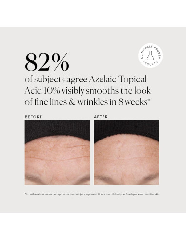 Naturium Ácido Tópico Azelaico 10% con Niacinamida 28.35 g