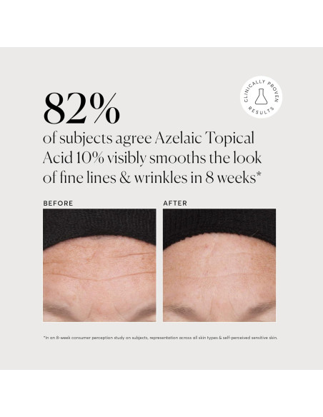 Naturium Ácido Tópico Azelaico 10% con Niacinamida 28.35 g