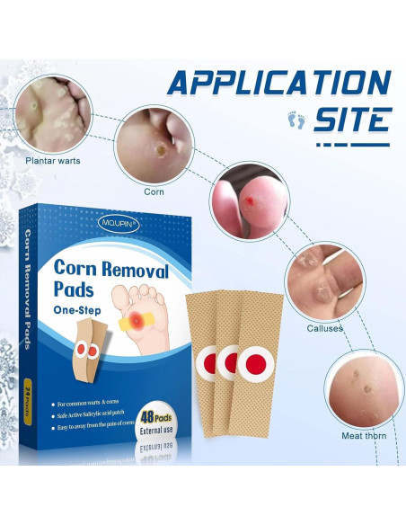 48 Almohadillas Removedoras de Callos MQUPIN - Efectivas y Naturales
