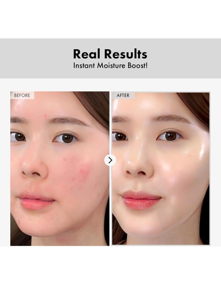 Ampolla de Ácido Hialurónico MANTONG 100ml Hidratante Facial