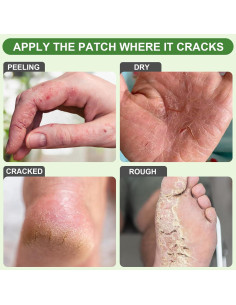 Parches para Talones Agrietados TEAWOO 25PCS Aloe Vera 2