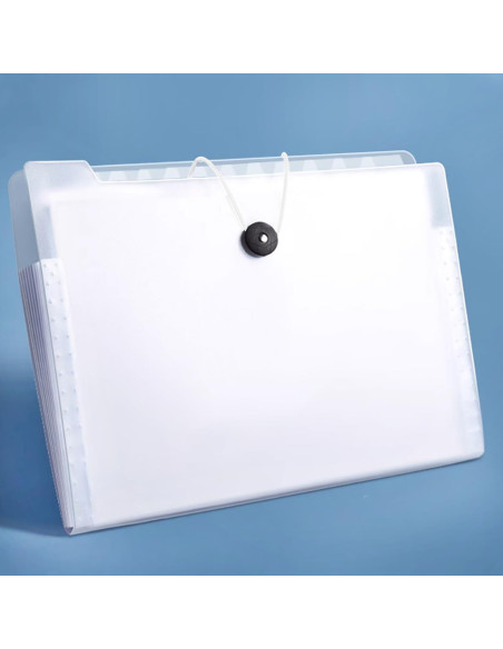 Cuerdas Elásticas con Extremos de Metal ONLYKXY 30pcs 30cm