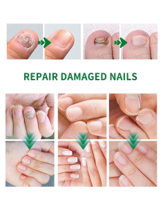 Suero de Crecimiento de Uñas Sytani 2PCS Esencia de Jengibre 2