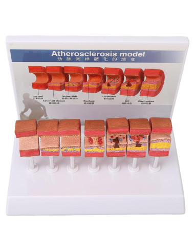 Modelo de Anatomía Arterial 7 Piezas LUCKDANO PVC Educativo