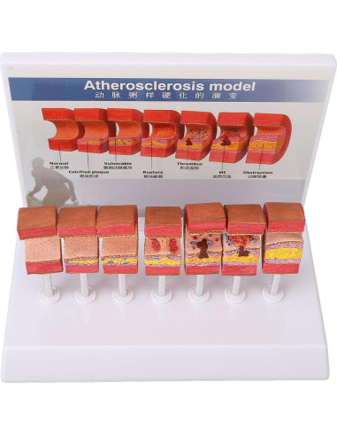 Modelo de Anatomía Arterial 7 Piezas LUCKDANO PVC Educativo