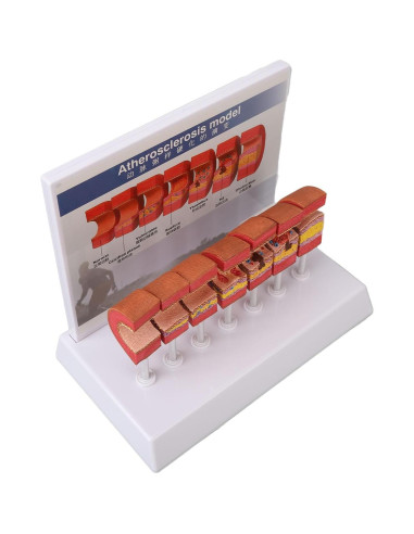 Modelo de Anatomía Arterial 7 Piezas LUCKDANO PVC Educativo