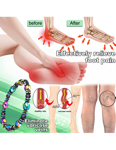 Pulsera Magnética de Drenaje Linfático AGSIXZLAN Ajustable