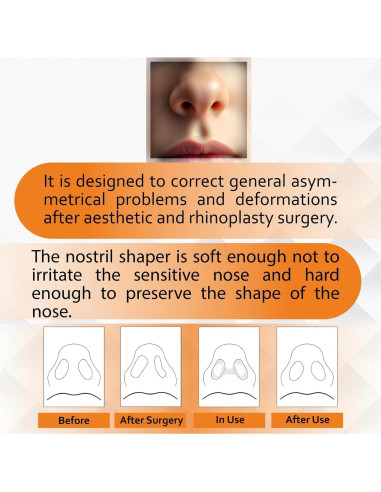 Retenedor Nasal Premium Nanovita - 2 Tamaños (5 y 6) - Silicona Médica