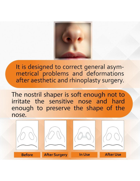 Retenedor Nasal Premium Nanovita - 2 Tamaños (5 y 6) - Silicona Médica Retenedor Nasal Premium Nanovita - 2 Tamaños (5 y 6) - Silicona Médica