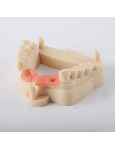 Resina 3D RESIONE D01S para Modelos Dentales - Alta Precisión