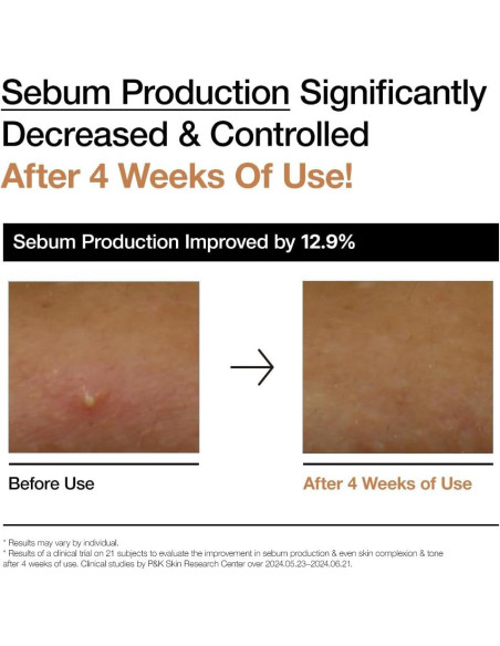 Tónico Lechoso ANUA Rice 70 Glow 250ml Hidratante Piel Tónico Lechoso ANUA Rice 70 Glow 250ml Hidratante Piel