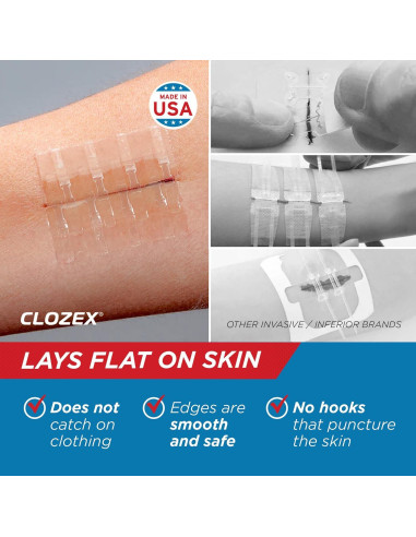 Clozex Cierres de Laceración - Repara Heridas Sin Puntos