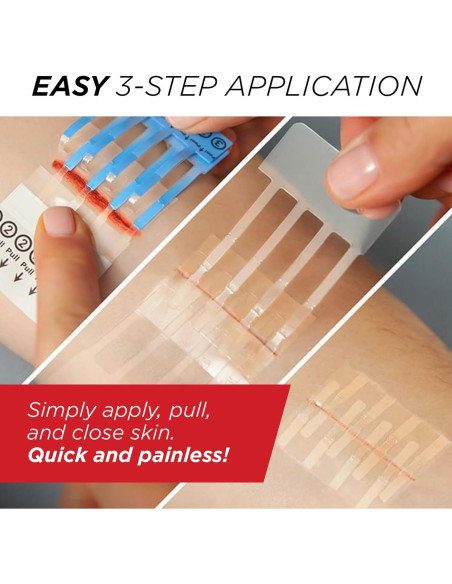 Clozex Cierres de Laceración - Repara Heridas Sin Puntos