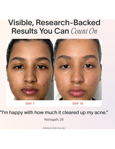 Dispositivo de Cuidado Facial Solawave | Terapia Luz Roja y Azul