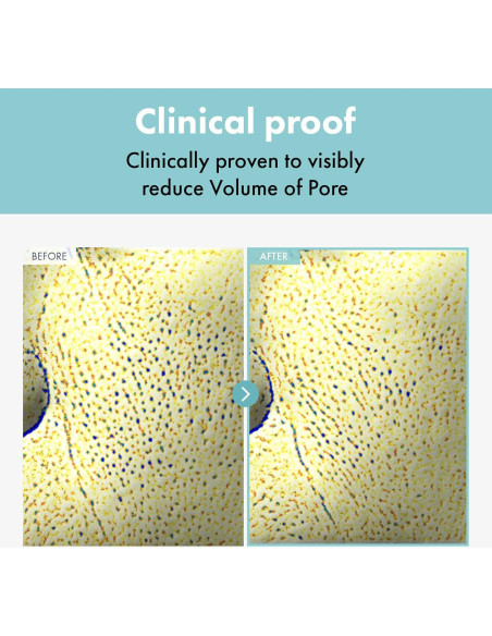 Crema Refinadora de Poros MANTONG 50g Hidratante Coreano