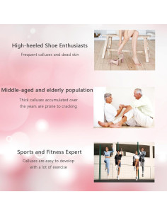 Removedor de Callos Eléctrico Dermave con 60 Discos de Lija 2