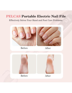 Lima de Uñas Eléctrica PELCAS Rosa, Inalámbrica 10 Velocidades 2
