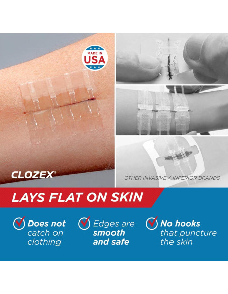 Clozex Cierre de Laceraciones - 2 Cierres Estériles 3,81 cm